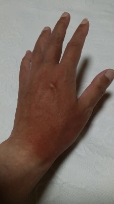 20170728_191043 (225x400)